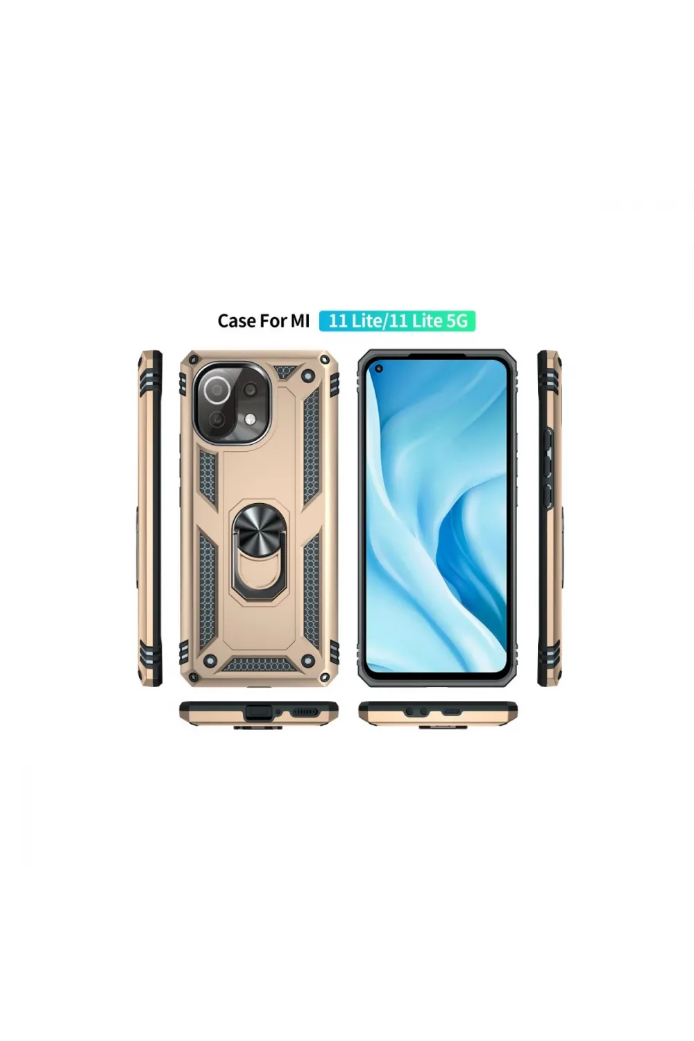 Xiaomi Mi 11 Lite Kılıf Sofya Yüzüklü Silikon Kapak - Gold