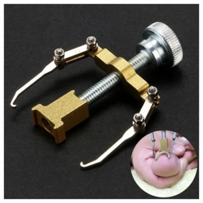 ieg™ Batık Tırnak Düzeltme Aleti