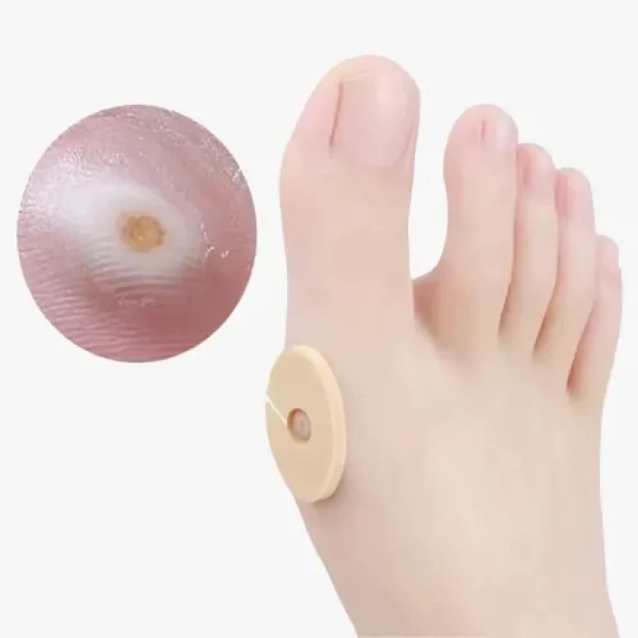 ieg ™ Nasır Bandı