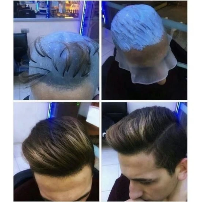 ieg™ Profesyonel Silikon Delikli Röfle Bonesi