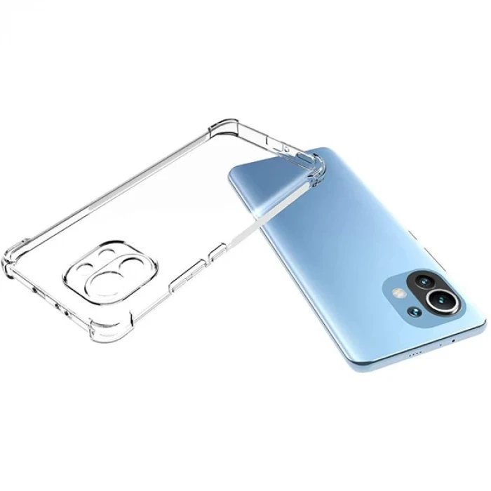 ieg™ Xiaomi Mi 11 Lite Kamera Korumalı Shockproof Şeffaf Silikon Kılıf