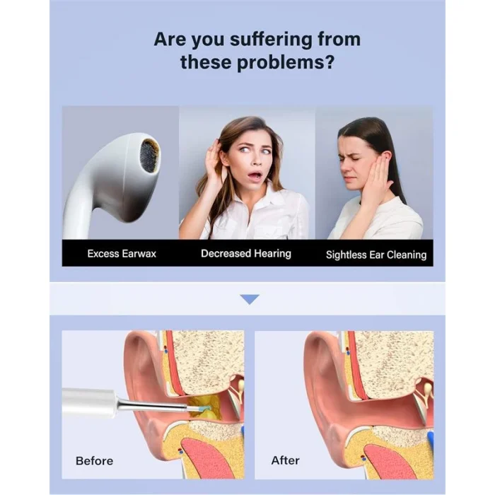 BEBIRD T5 3MP KAMERA 3.5MM LENS ŞARJLI WIFI GÖRÜNTÜLÜ KULAK TEMİZLEYİCİ BEYAZ RENK