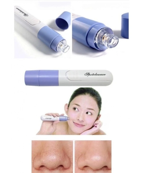 Pore Cleaner Vakumlu Yüz Temizleme Siyah Nokta Temizleme Cihazı