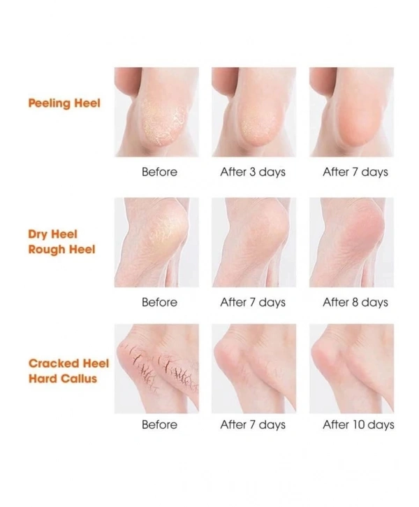 Silikon Topuk Nemlendirici Çorap