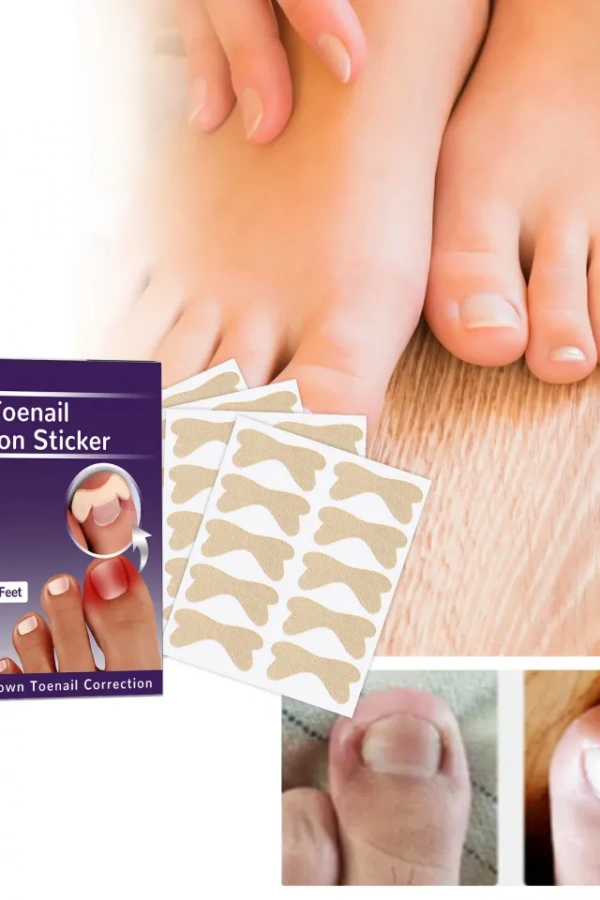 Ayak Tırnağı Düzeltme Bandı 50 Adet