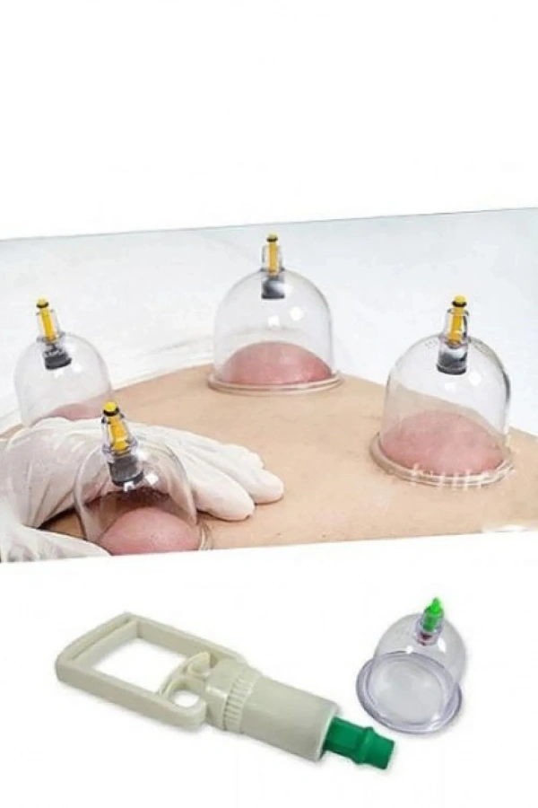 Hacamat Seti - Vakumlu Kupa Çekme Seti (Model 2)