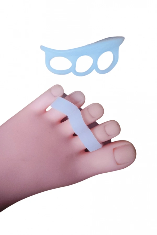 İleri derecede çekiç parmak yastığı