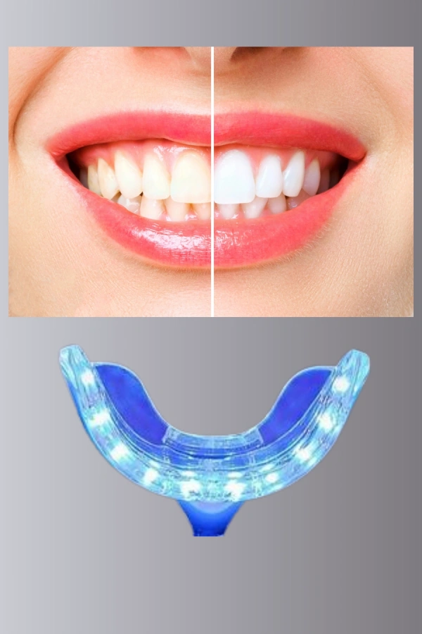 LED Işıklı Profesyonel Diş Beyazlatma Seti