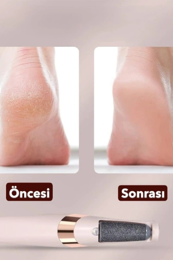 Şarjlı Ayak Törpüsü - Pedikür ve Ayak Bakım Aleti