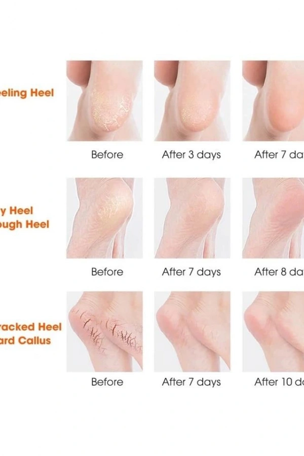 Silikon Topuk Nemlendirici Çorap