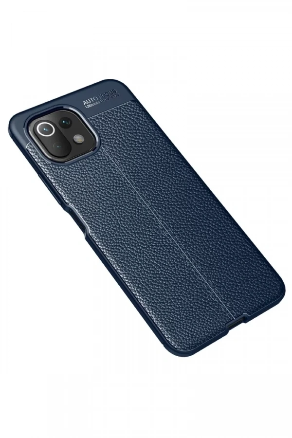 Xiaomi Mİ 11 Lite Kılıf Auto Focus Kapak - Lacivert
