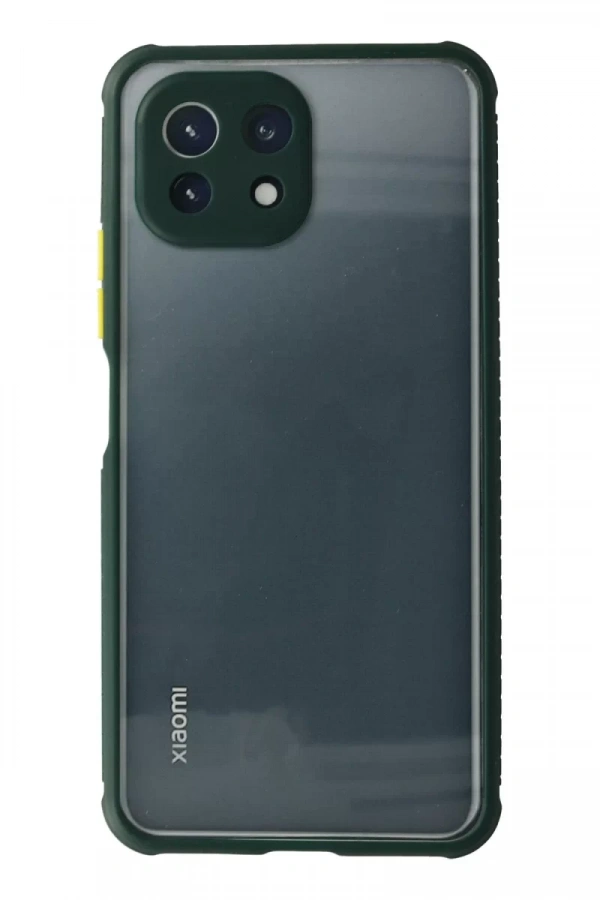 Xiaomi Mİ 11 Lite Kılıf Miami Şeffaf Silikon - Koyu Yeşil