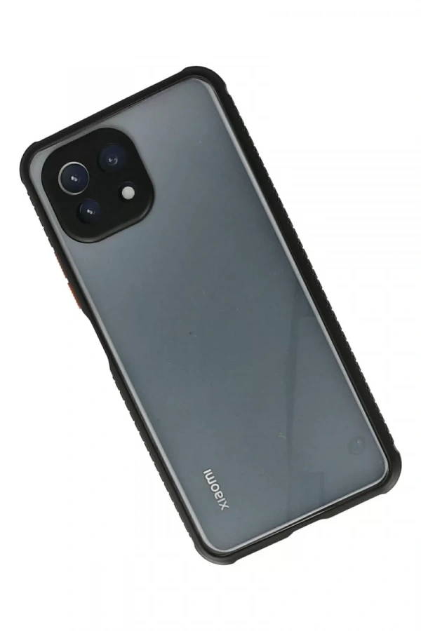 Xiaomi Mİ 11 Lite Kılıf Miami Şeffaf Silikon - Siyah
