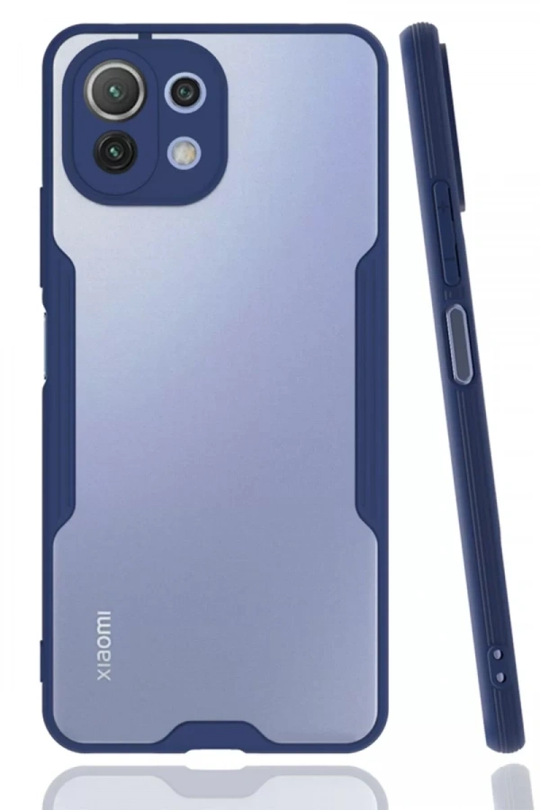Xiaomi Mİ 11 Lite Kılıf Platin Silikon - Lacivert