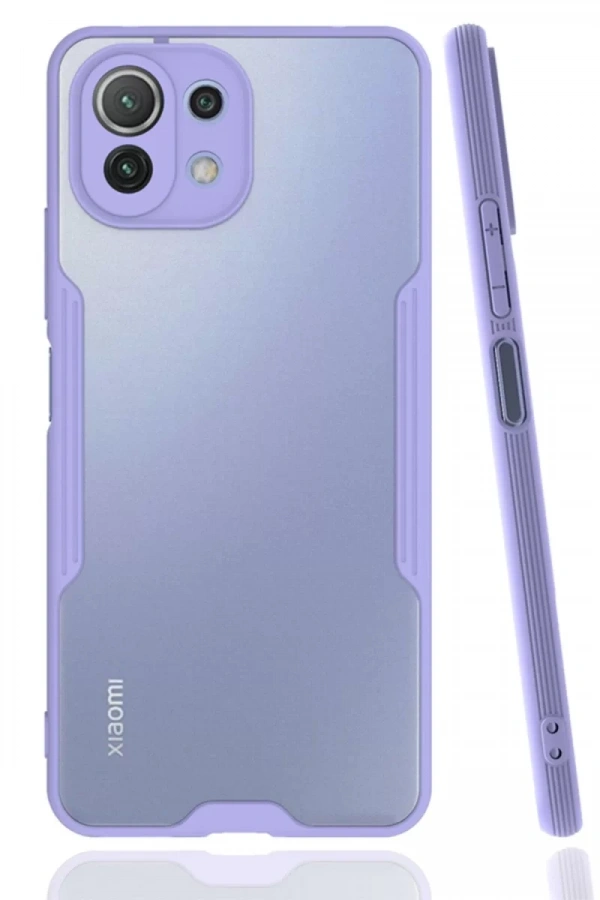 Xiaomi Mİ 11 Lite Kılıf Platin Silikon - Lila