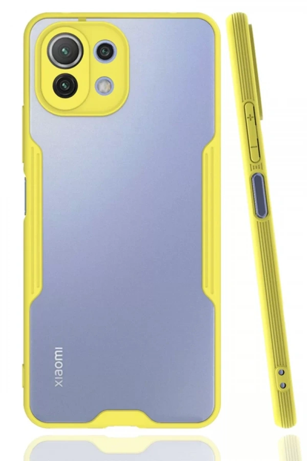 Xiaomi Mİ 11 Lite Kılıf Platin Silikon - Sarı