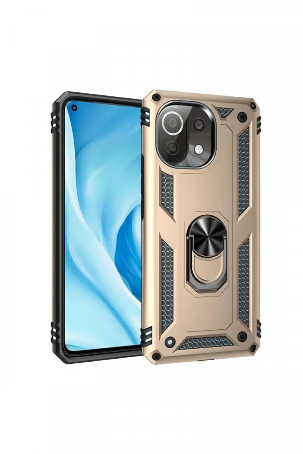 Xiaomi Mİ 11 Lite Kılıf Sofya Yüzüklü Silikon Kapak - Gold