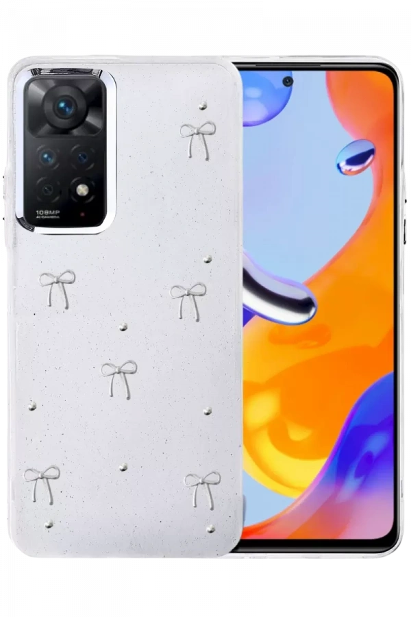 Xiaomi Redmi Note 11 Pro Fiyonk Desenli Kapak - Desen 5