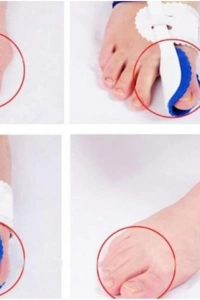 Baş Parmak Kemik Düzeltici Gece Ateli (Çift)