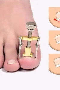 Batık Tırnak Çıkarma Aparatı