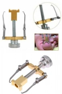 Batık Tırnak Düzeltme Aleti