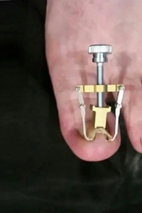 Batık Tırnak Düzeltme Aleti