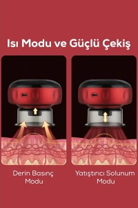 Elektronik Vakum Hacamat Aleti