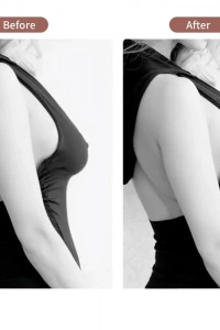 Göğüs Dikleştirme Bandı S Beden 2.5 Cm.