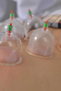 Hacamat Kupa Seti 6 Adet