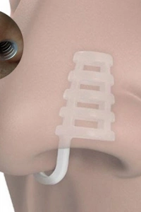 Horlama Burun Aparatı - Kafesli