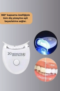 LED Işıklı Profesyonel Diş Beyazlatma Seti