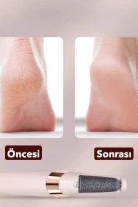 Şarjlı Ayak Törpüsü - Pedikür ve Ayak Bakım Aleti