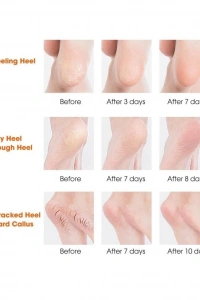 Silikon Topuk Nemlendirici Çorap