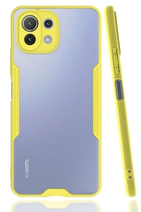 Xiaomi Mİ 11 Lite Kılıf Platin Silikon - Sarı