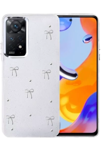 Xiaomi Redmi Note 11 Pro Fiyonk Desenli Kapak - Desen 5