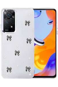 Xiaomi Redmi Note 11 Pro Fiyonk Desenli Kapak - Desen 8