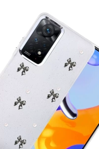 Xiaomi Redmi Note 11 Pro Fiyonk Desenli Kapak - Desen 8
