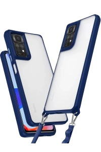 Xiaomi Redmi Note 11 Pro Kılıf Penta Silikon Kılıf - Lacivert