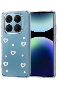 Xiaomi Redmi Note 14 Pro 4G Fiyonk Desenli Kapak - Desen 10
