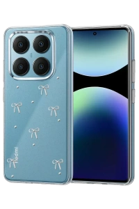 Xiaomi Redmi Note 14 Pro 4G Fiyonk Desenli Kapak - Desen 5