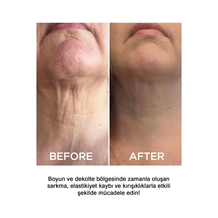 Anti-aging Krem – Nemlendirici Ve Kırışıklık Karşıtı Yüz & Boyun Bakım Kremi