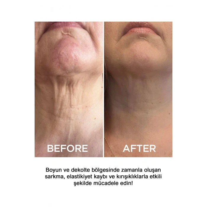 Sıkılaştırıcı Boyun Kremi 50ml | Lifting & Nemlendirici Bakım