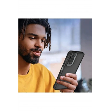 Mey İthalat® Redmi Note 11 Kılıf Elegant Kapak - Pudra