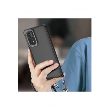 Mey İthalat® Redmi Note 11 Kılıf Elegant Kapak - Pudra
