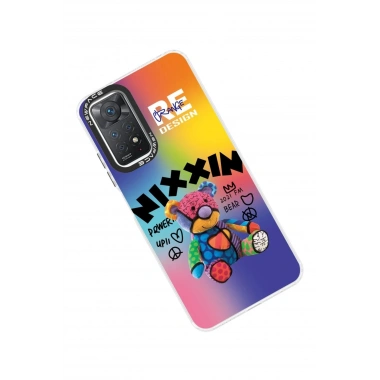 Mey İthalat®   Redmi Note 11 Pro Kılıf Estoril Desenli Kapak - Estoril - 11