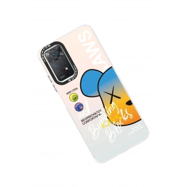 Mey İthalat®   Redmi Note 11 Pro Kılıf Estoril Desenli Kapak - Estoril - 6