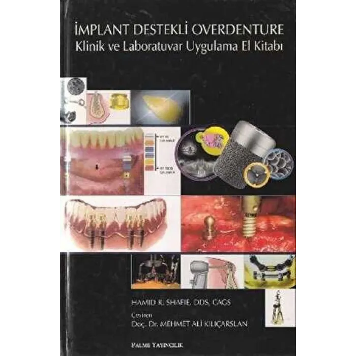 İmplant Destekli Overdenture