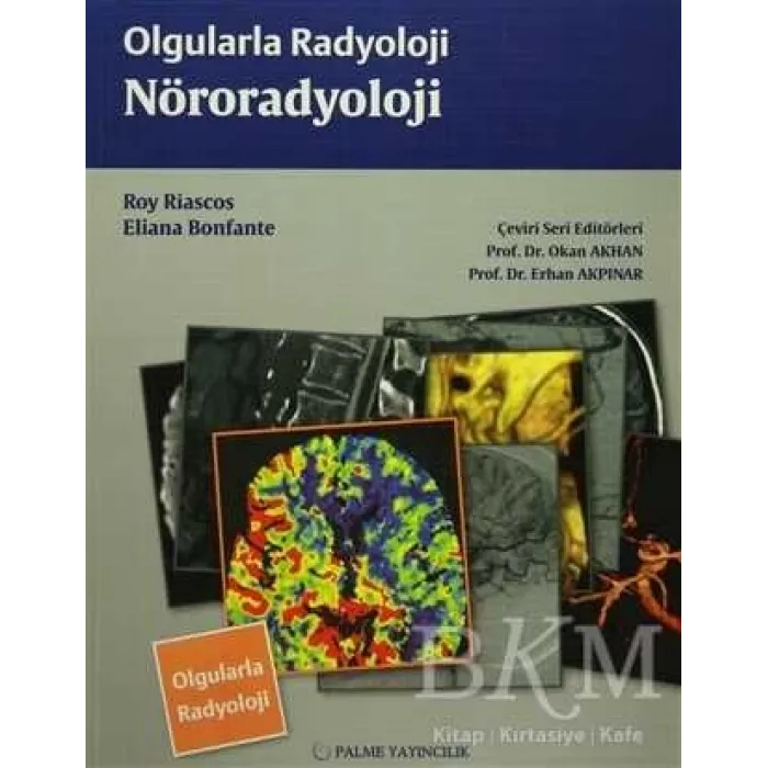 Olgularla Radyoloji Nöroradyoloji