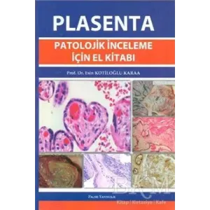 Plasenta Patolojik İnceleme İçin El Kitabı