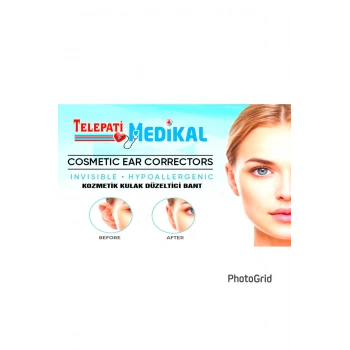 KEPÇE KULAK BANDI,20 ADET KOZMETİK KULAK DÜZELTİCİ BANT